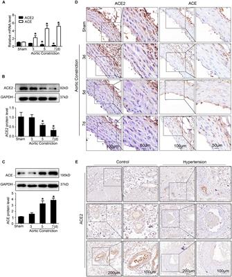 Mechanical Stretch Induces Smooth Muscle Cell Dysfunction by Regulating ACE2 via P38/ATF3 and Post-transcriptional Regulation by miR-421